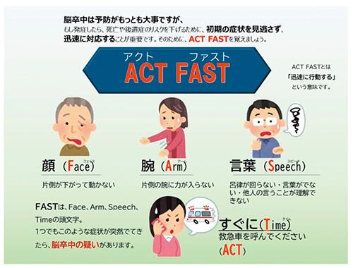 ACT-FAST