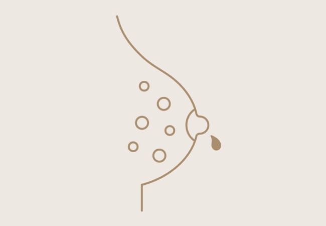乳糖分泌